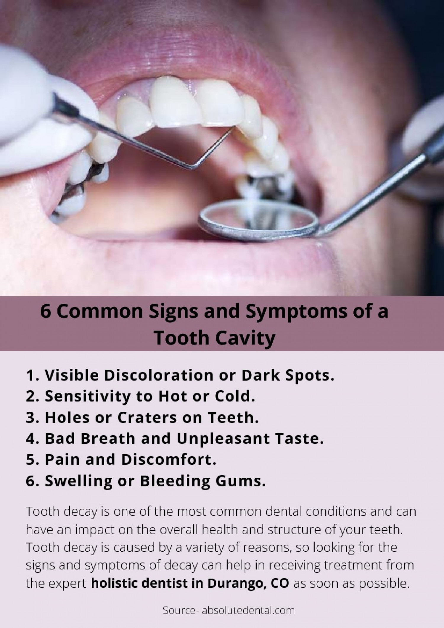 6 Common Signs and Symptoms of a Tooth Cavity Infographic