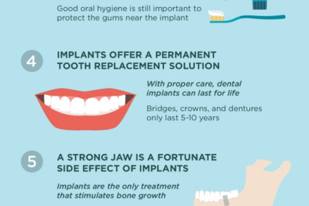 7 Surprising Facts About Dental Implants  Infographic