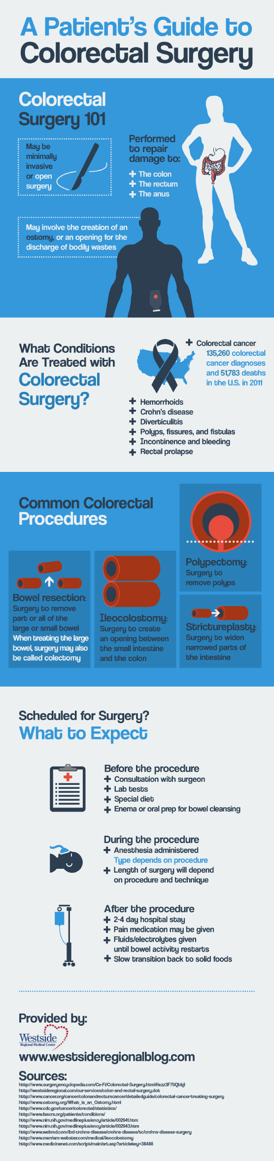 A Patient’s Guide to Colorectal Surgery | Visual.ly