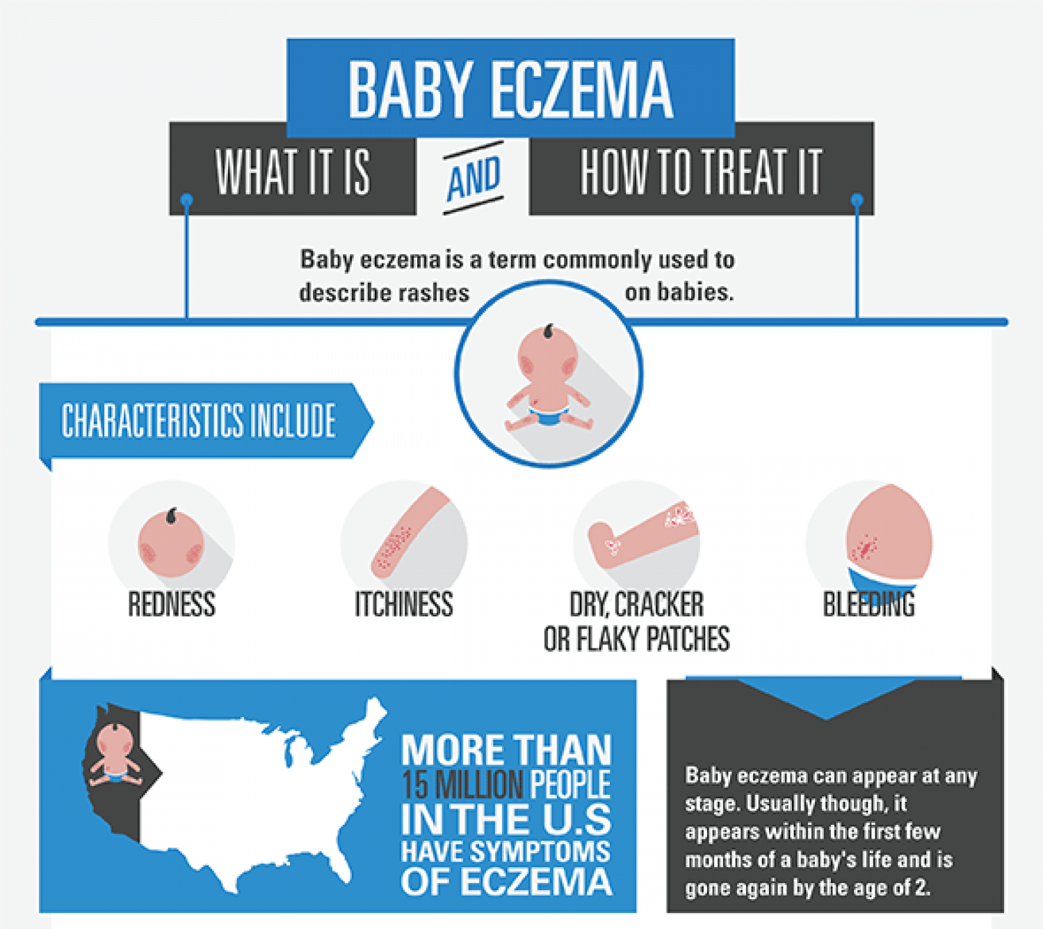 Baby  Eczema Infographic