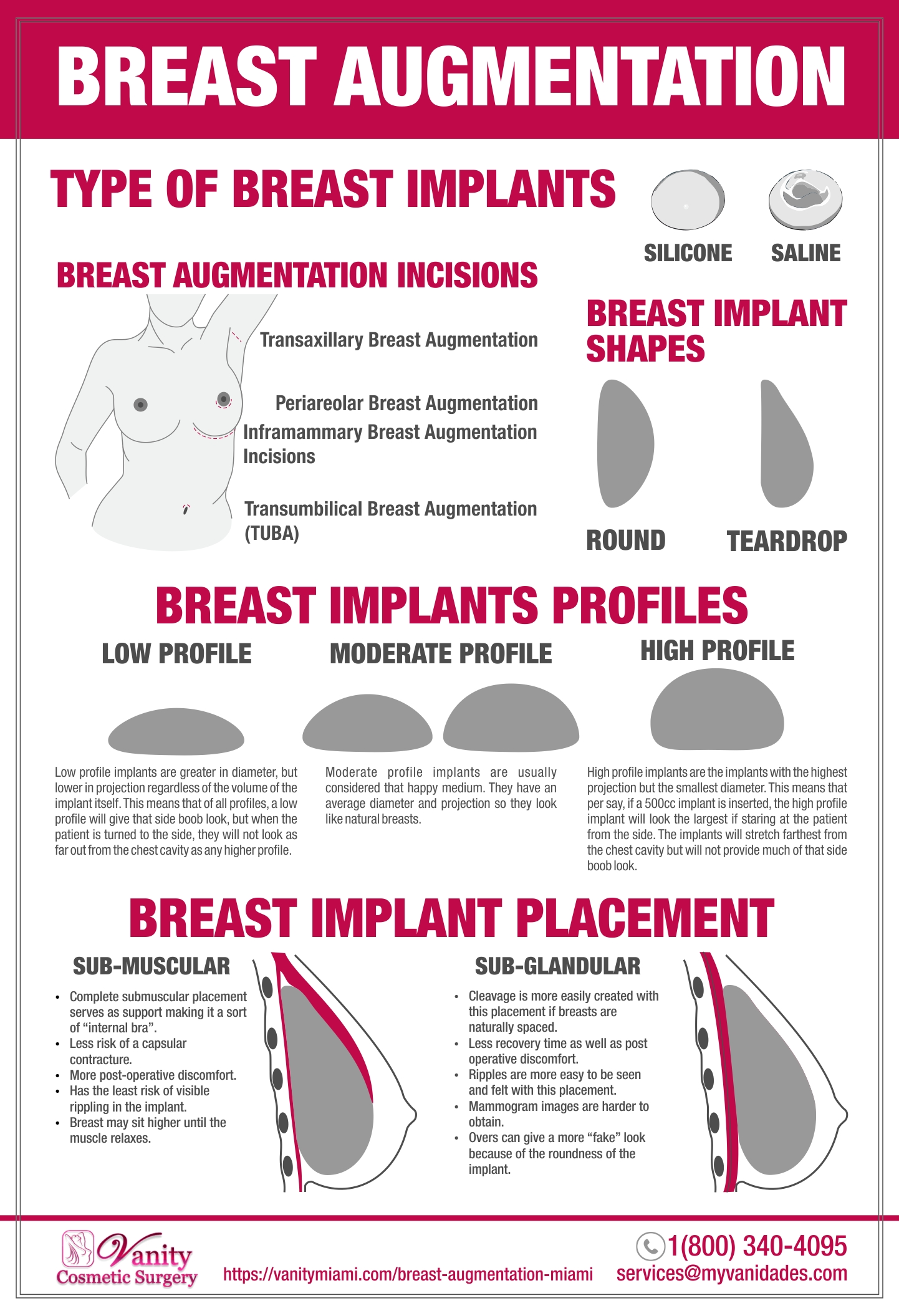 All about breast implant profiles