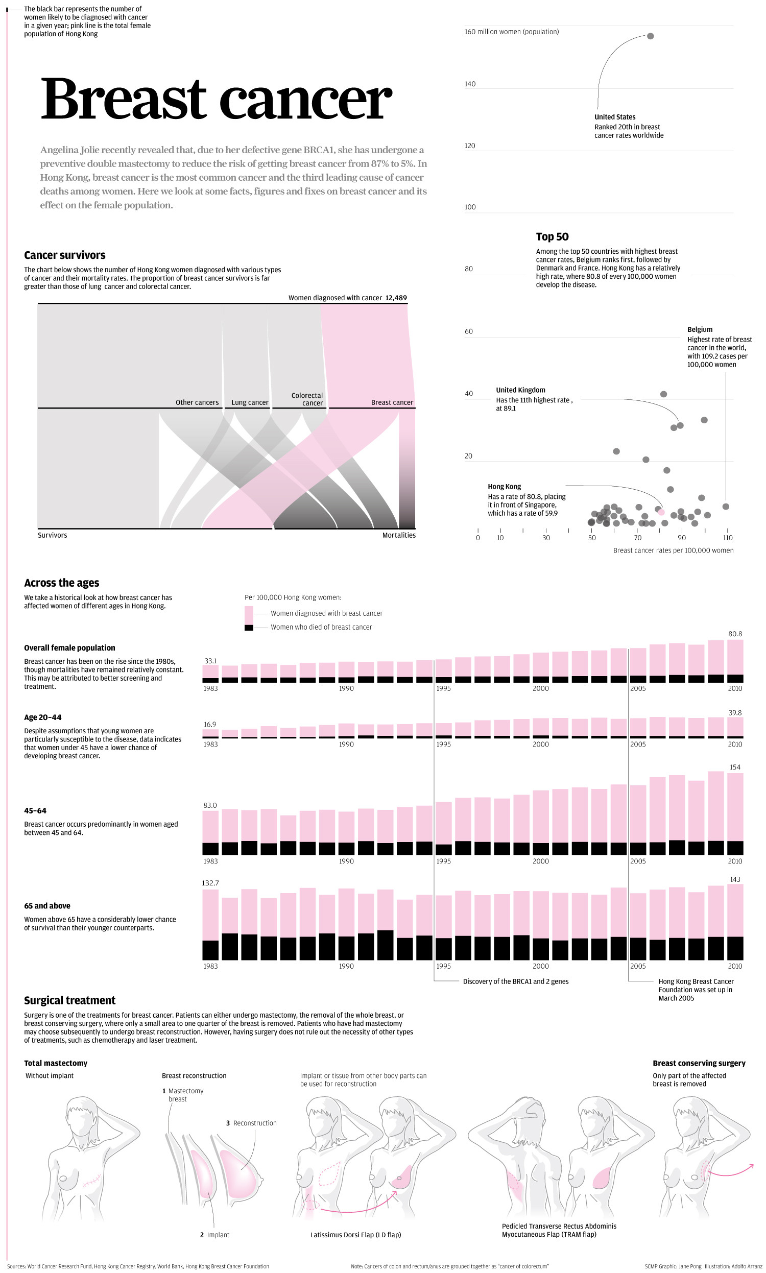 Breast cancer in Hong Kong Infographic