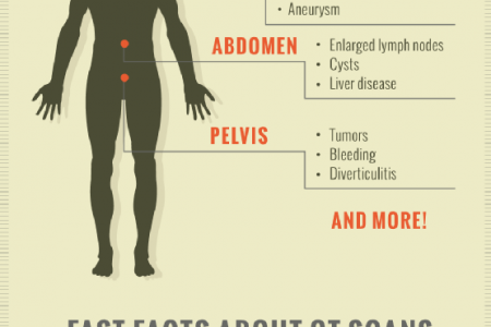 CT Scans: An Inside Look at the Scan that Looks Inside  Infographic