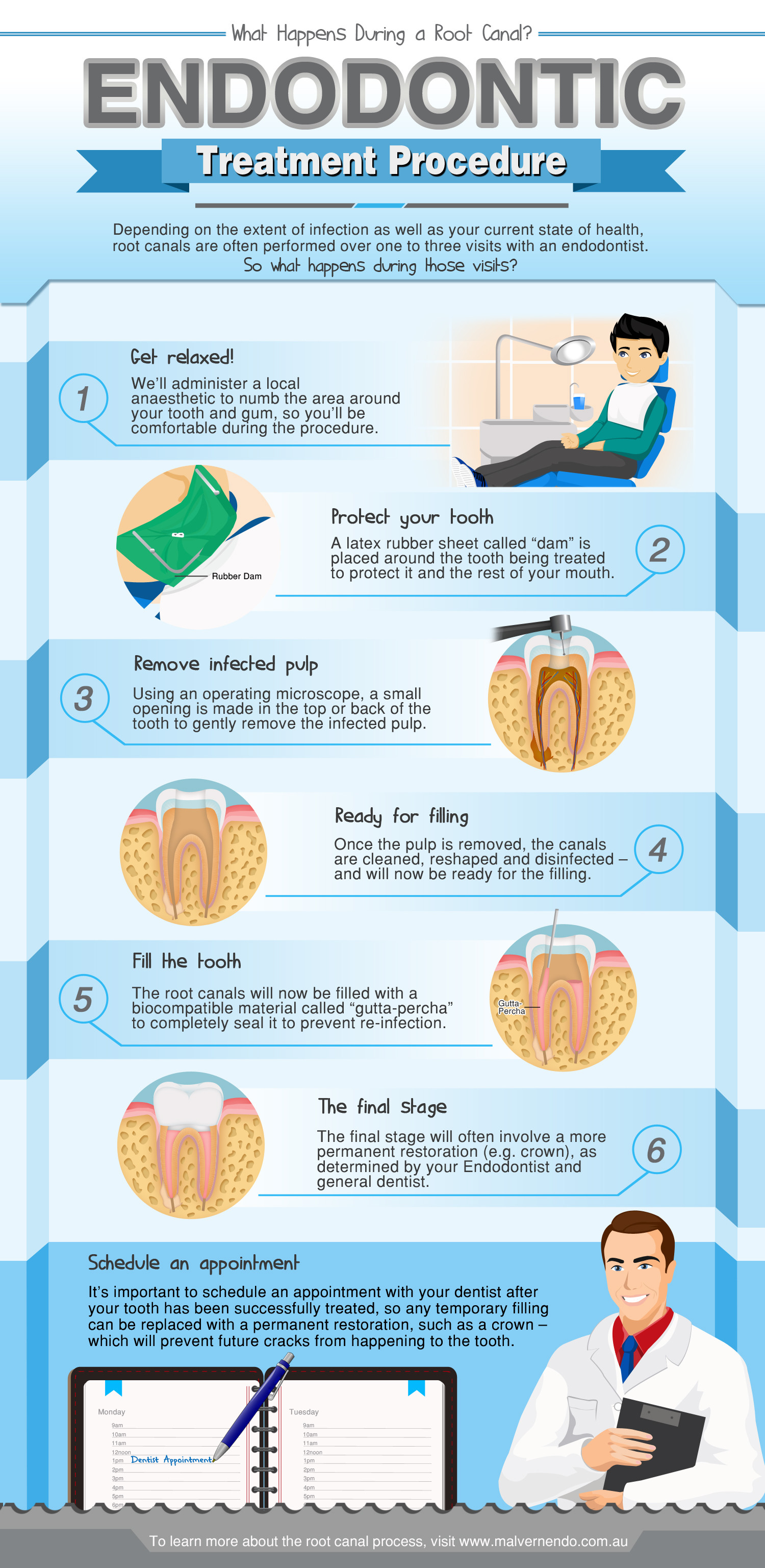 Endodontic Treatment Procedure: What Happens During a Root Canal? Infographic