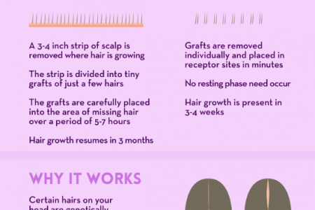 Hair Today, Hair Tomorrow: Getting Your Hair Back Infographic