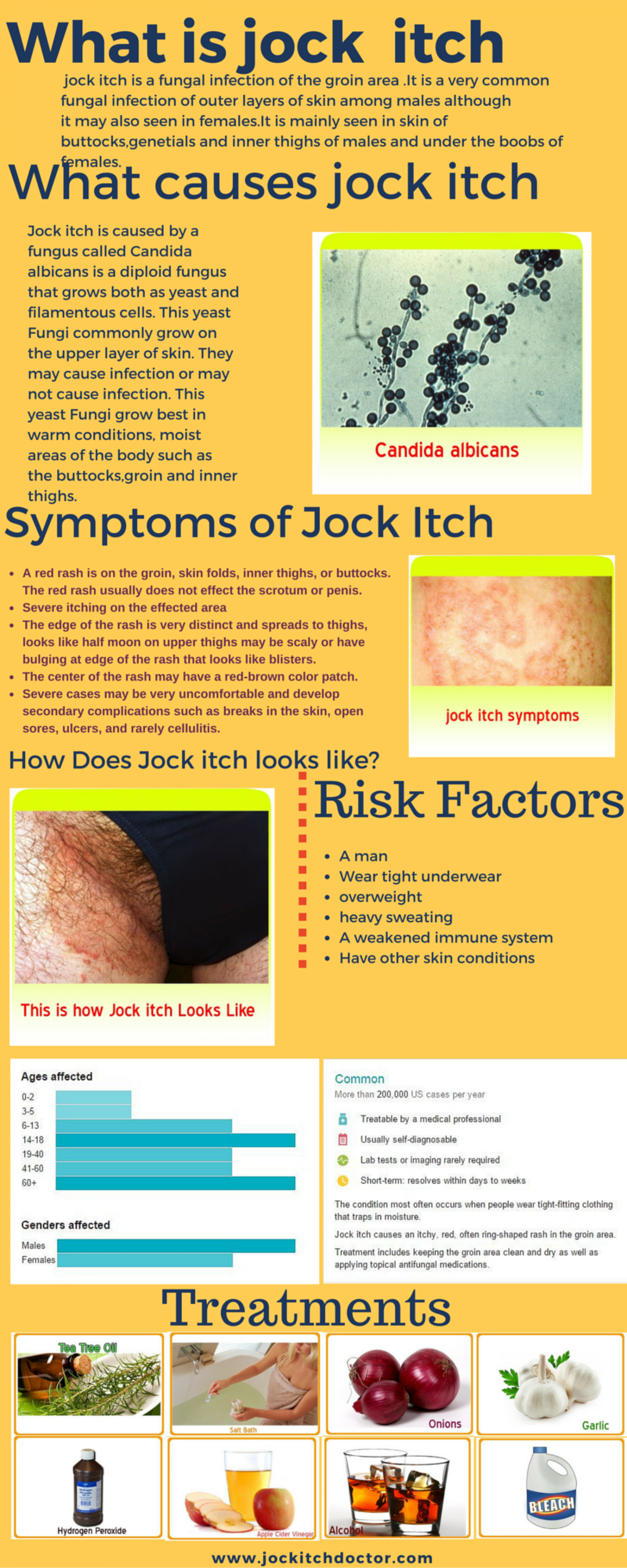 Herpes or Jock Rash-what's the Difference? Infographic