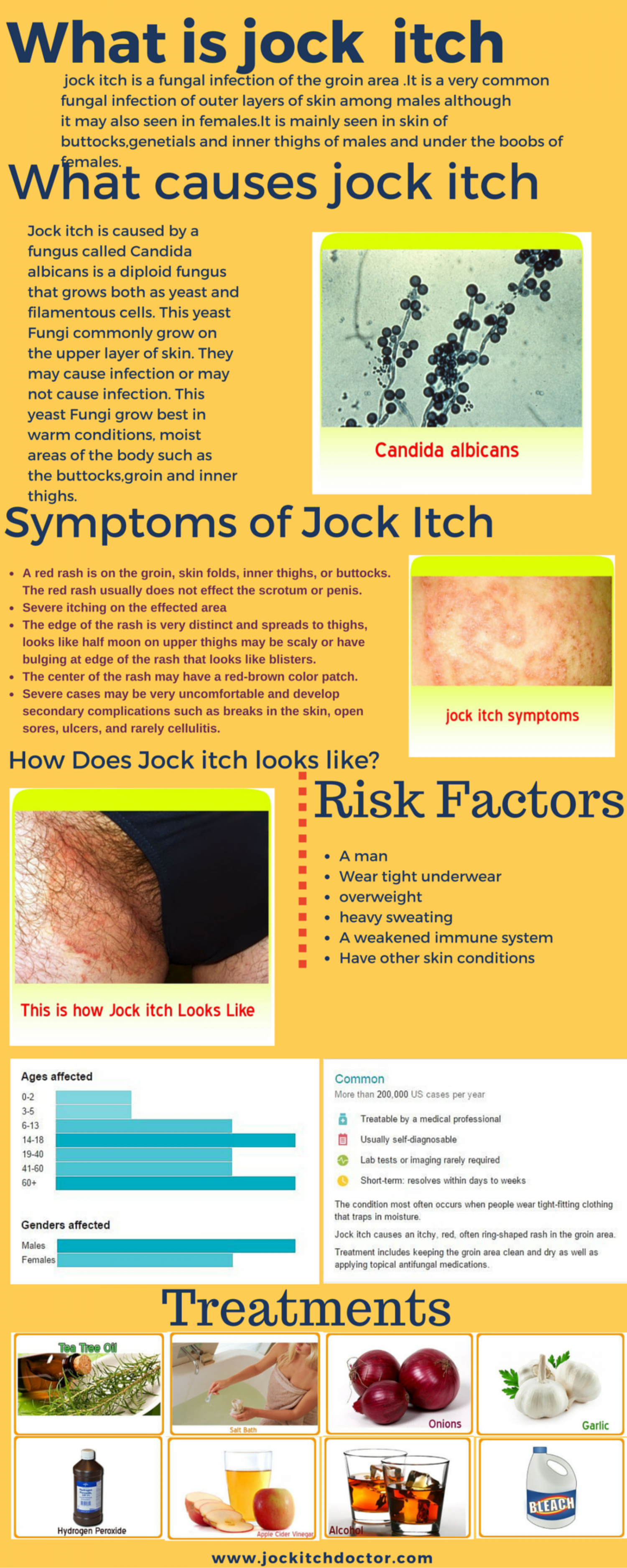 Herpes or Jock Rash-what's the Difference?