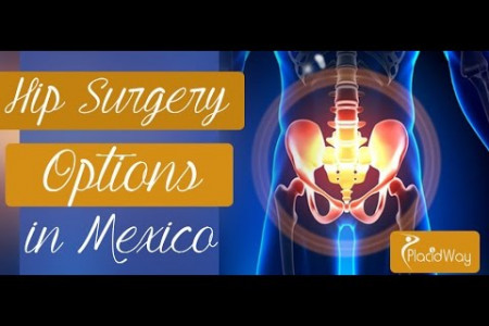 Hip Replacement in Mexico Infographic