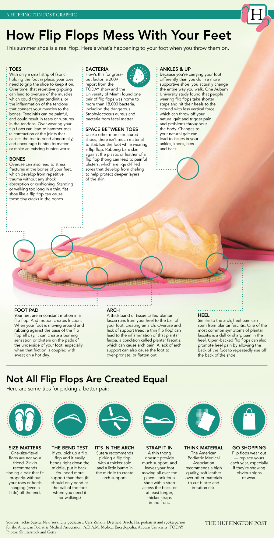 Flip Flops: Do They Hurt Your Feet?