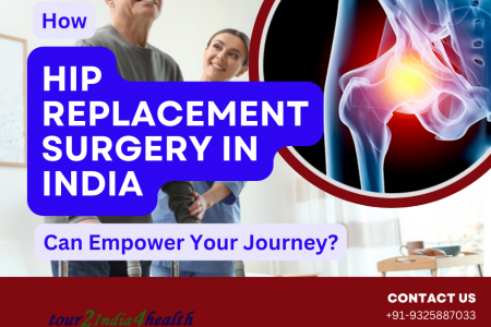 How Hip Replacement Surgery in India Can Empower Your Journey? Infographic
