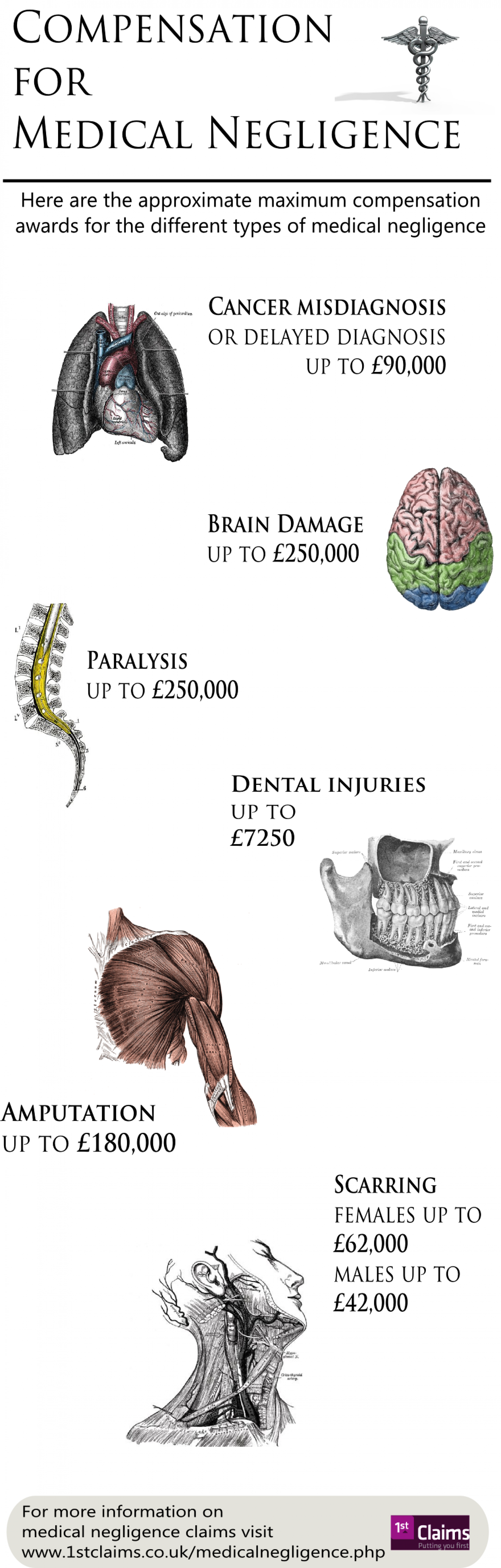 How Much Compensation for Medical Negligence Infographic