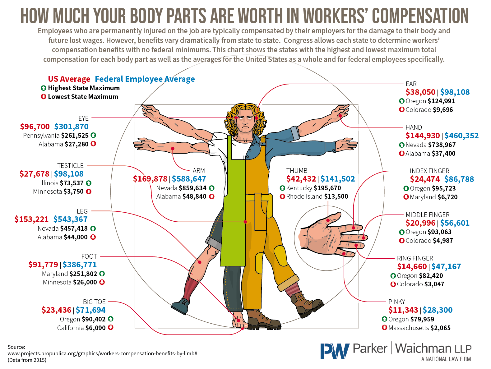 Which body part has the highest value in a workers compensation claim?