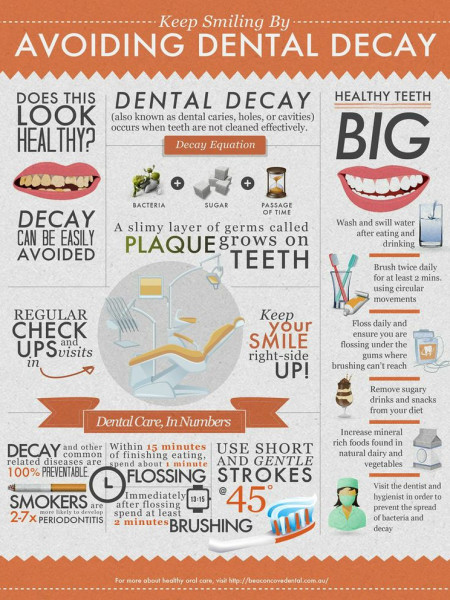 Keep smiling by avoiding dental decay  Infographic