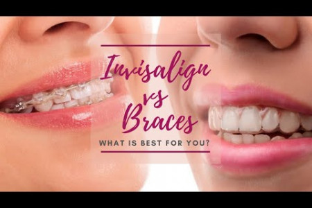 Invisalign vs Braces: What Is Best For You? Infographic