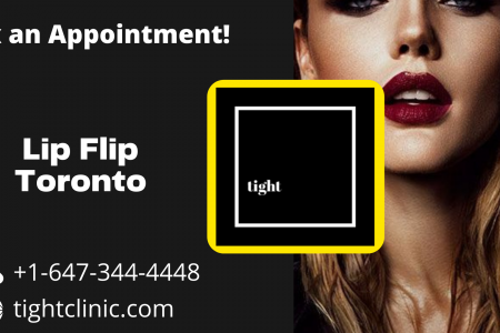 Lip Flip Toronto Infographic
