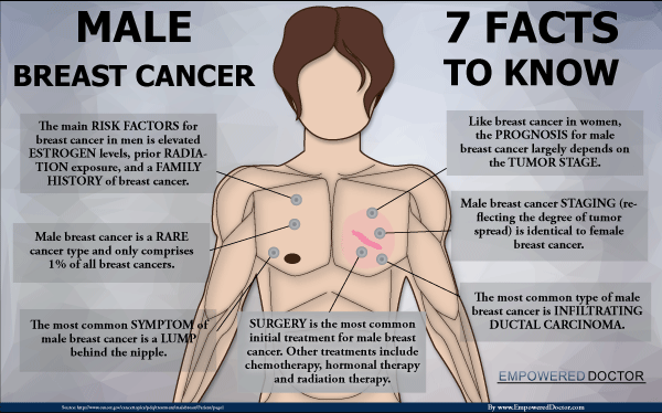 Male Breast Cancer - 7 Facts to Know Infographic