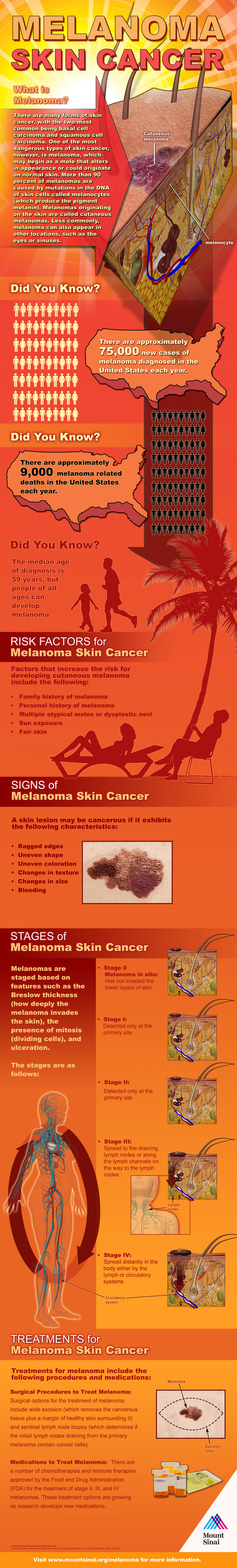 Melanoma Skin Cancer  Infographic