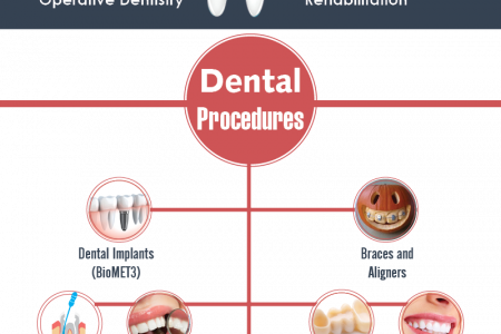 Mexico Top Cities for Dental Care Infographic