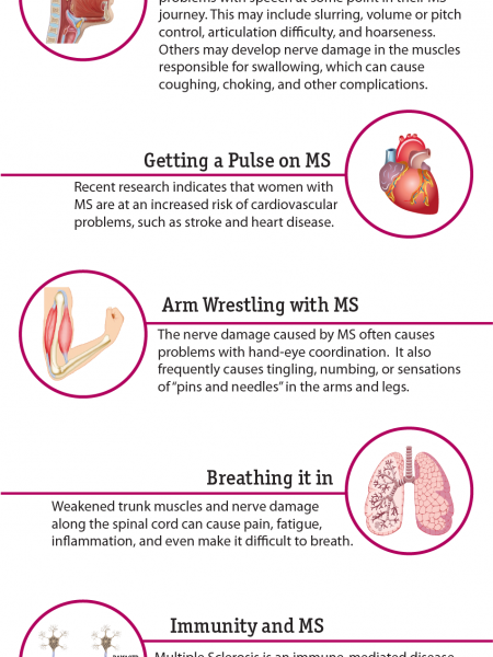 Multiple Sclerosis From Top to Bottom Infographic