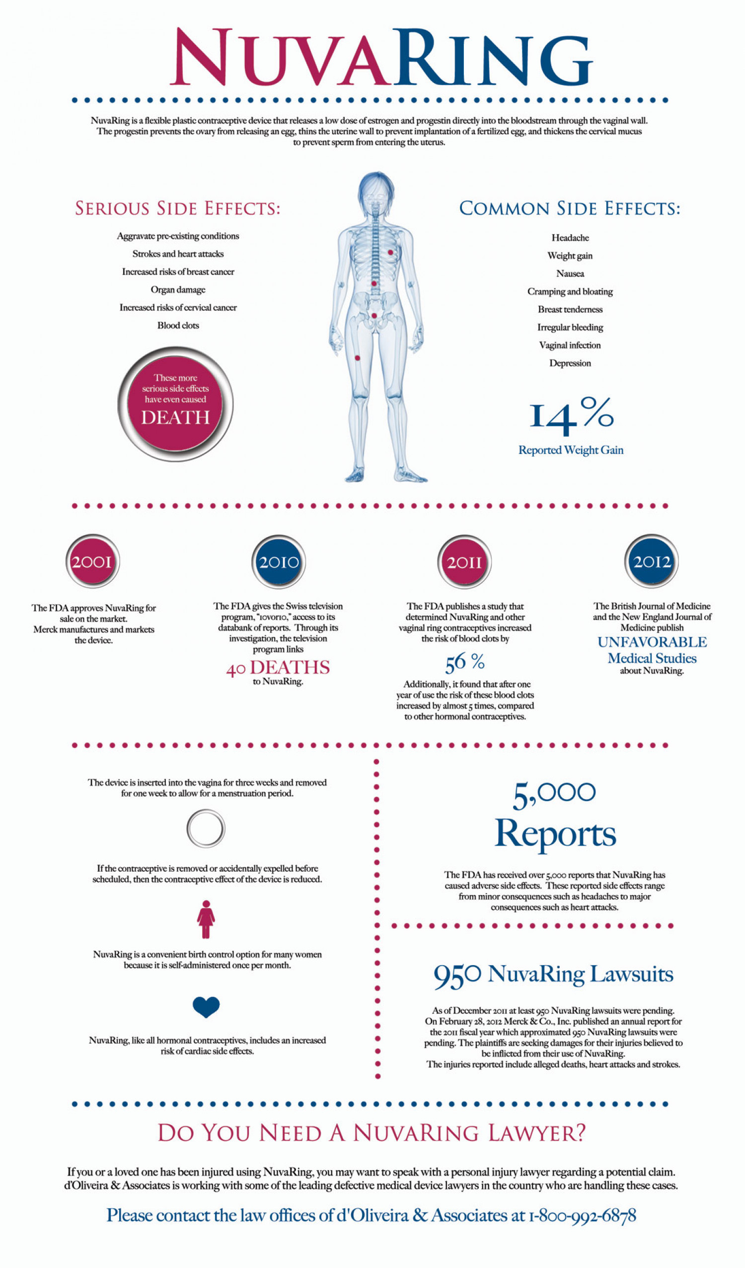 nuvaring Infographic