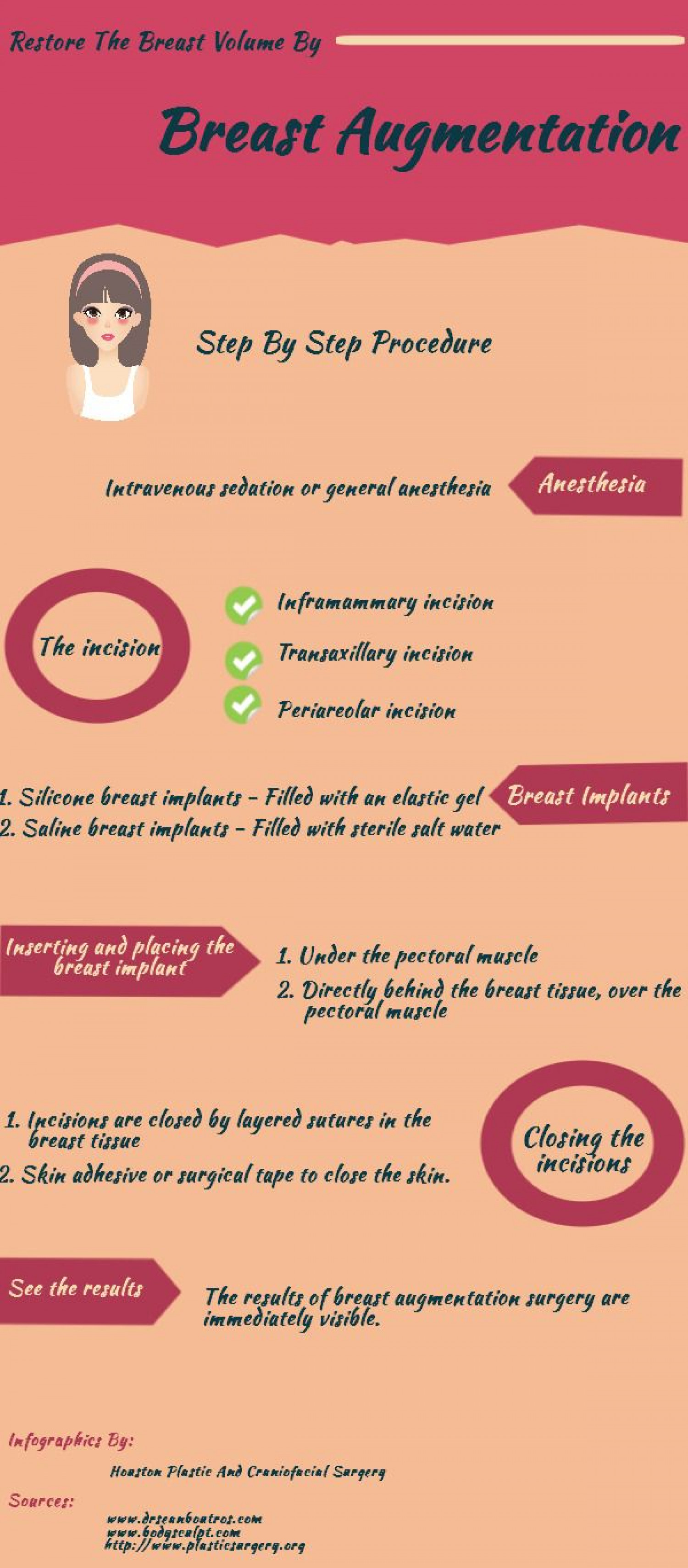 Restore The Breast Volume By Breast Augmentation Infographic