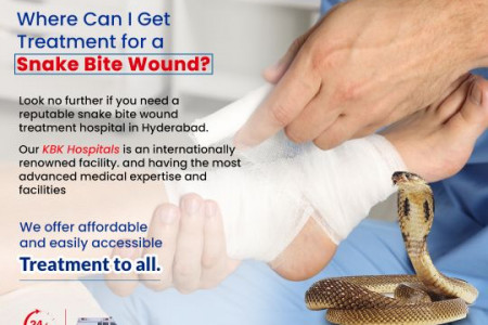 Snakebite Treatment in Hyderabad Infographic