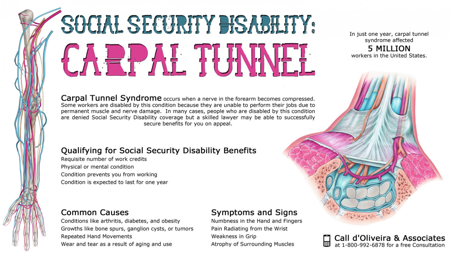 Social Security Disability: Carpal Tunnel Syndrome Infographic