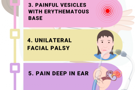 Symptoms Of Herpes Zoster Oticus Infographic