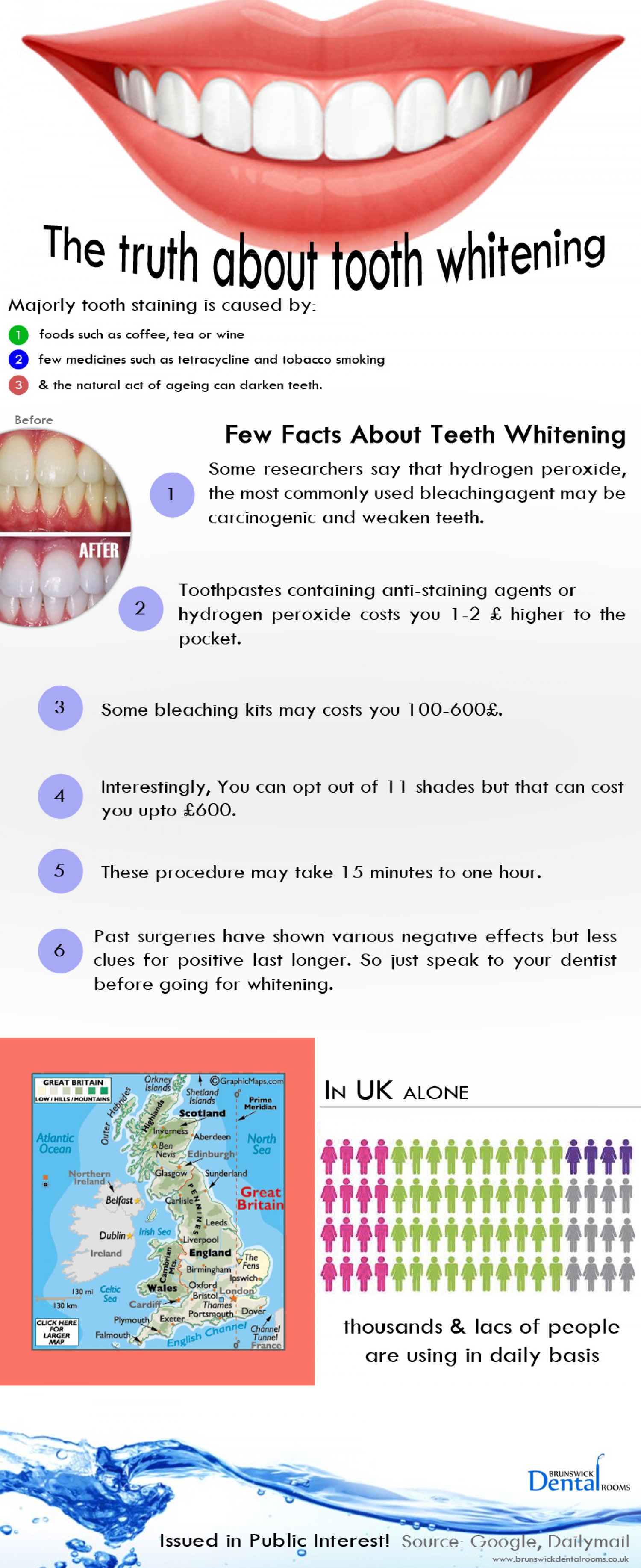 The truth about tooth whitening Infographic