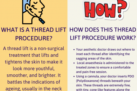 Thread Lift In Singapore: What Is It And How Does It Work? Infographic
