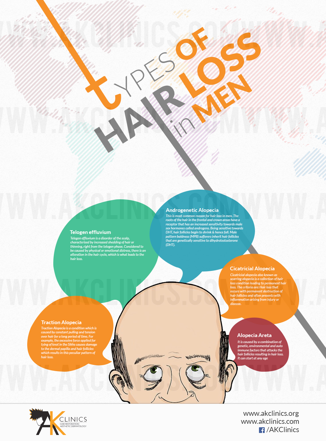 Types of Hair Loss in Men, Infographic