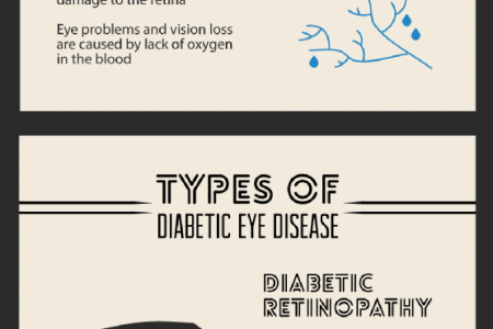 Understanding the Diabetic Eye Infographic