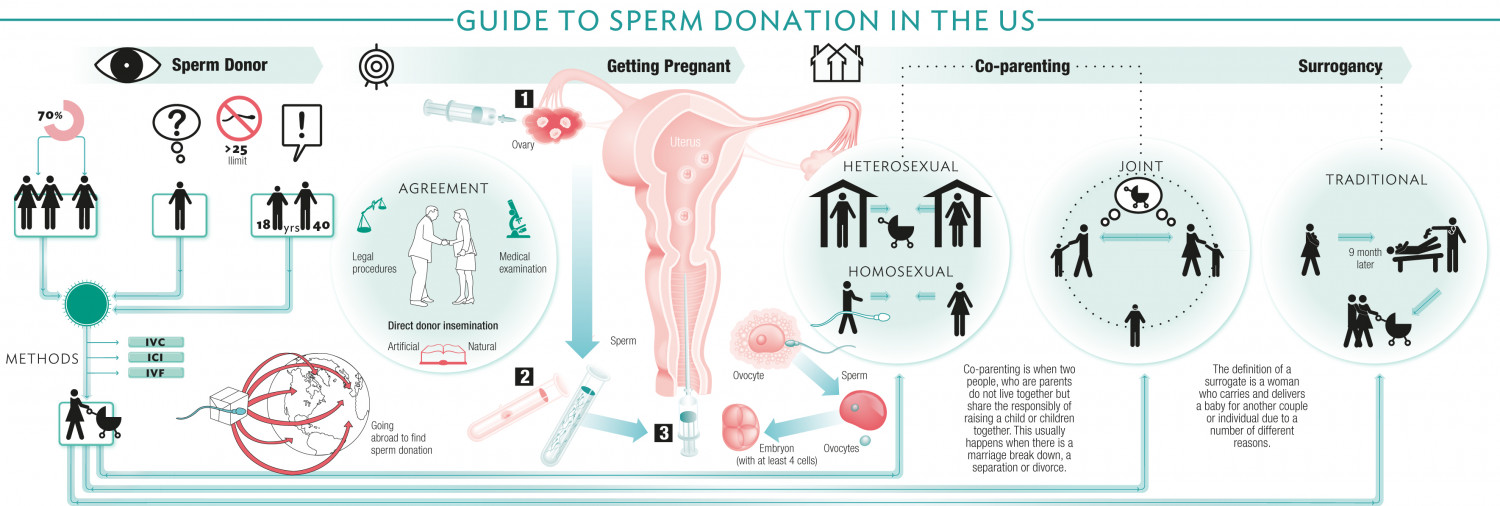 Guide to Sperm Donation in the US Infographic