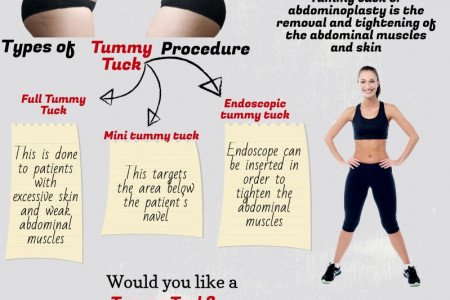 What is Tummy Tuck? Infographic