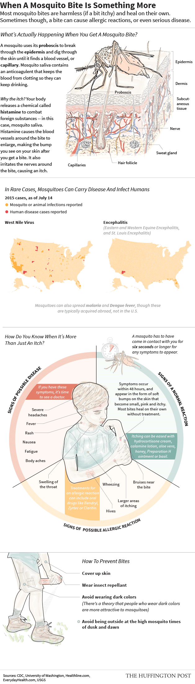 When A Mosquito Bite Is Something More Infographic
