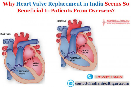 Why Heart Valve Replacement in India Seems So Beneficial to Patients From Overseas? Infographic